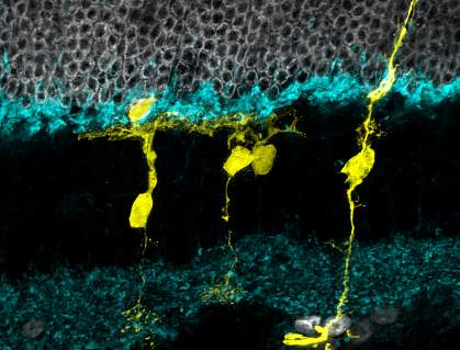 Image of a mouse retina under a fluorescent microscope Image of a mouse retina under a fluorescent microscope