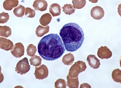Micrograph of Giemsa-stained monocytes Micrograph of Giemsa-stained monocytes