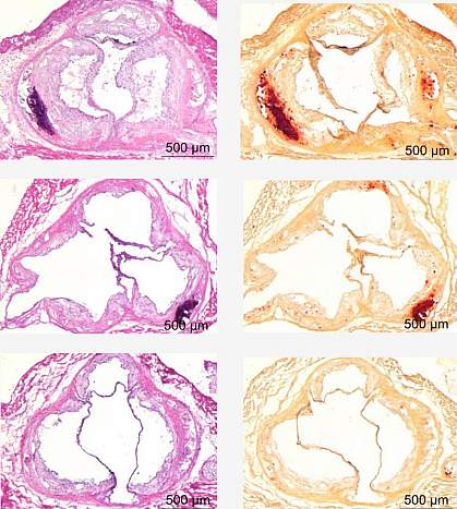 The aorta of a mouse fed a low-potassium diet has more calcification than that of a mouse mice fed a normal diet. The mouse fed a high-potassium diet has less calcification.