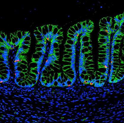 Human intestinal organoids in mouse intestine