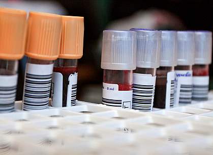 Blood tubes in laboratory Blood tubes in laboratory