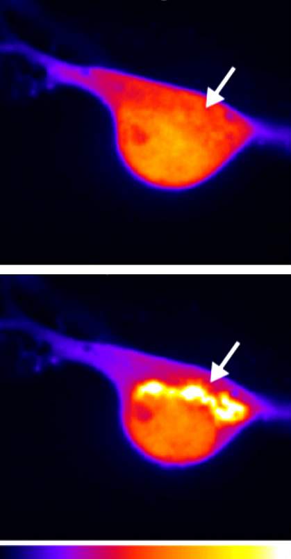 Micrographs of nerve cell