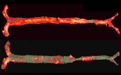 Mouse arteries Mouse arteries