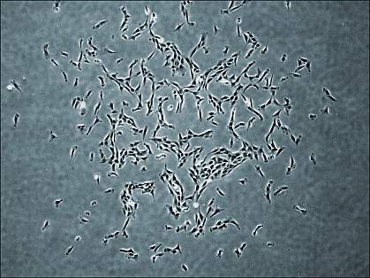 Human skeletal stem cells