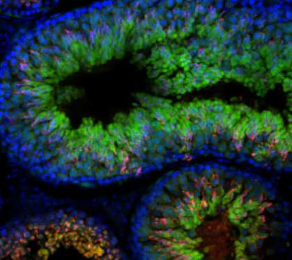 Sperm in mouse testes Sperm in mouse testes