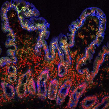 Confocal image of the human small intestine