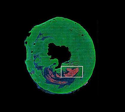 Section of mouse heart