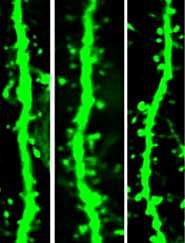 Dendrites with spines