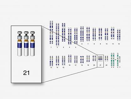 Down syndrome chromosome set