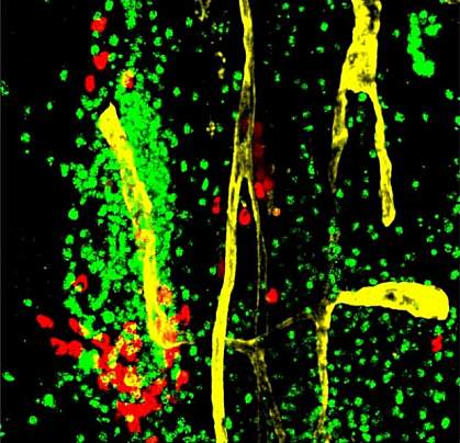 Immune cells in dura mater