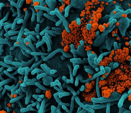 Novel Coronavirus SARS-CoV-2