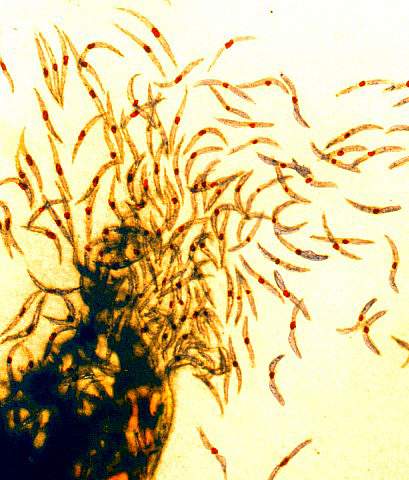 Malaria sporozoites, the infectious form of the malaria parasite that is injected into people by mosquitoes. 