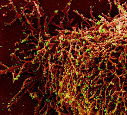 Novel coronavirus SARS-CoV-2 Novel coronavirus SARS-CoV-2