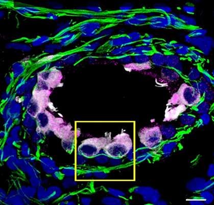 Inner ear organoid