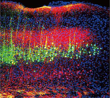 Neurons in a mouse brain’s auditory cortex Neurons in a mouse brain’s auditory cortex