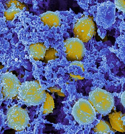 Scanning electromicrograph of Staphylococcus aureus bacteria Scanning electromicrograph of Staphylococcus aureus bacteria