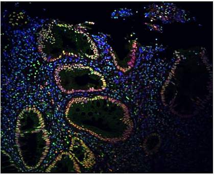 Immunofluorescence signal is strong in the epithelial cells surrounding colon spaces.