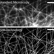 Structured Illumination Microscopy
