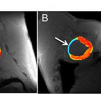 CEST MRI.