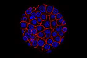 Pancreatic Cancer Cells