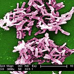 Clostridium difficile bacteria.