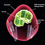 3-D image of the prostate