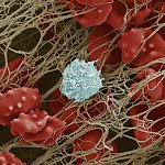 Scanning electron micrograph of blood cells trapped in a fibrous mesh