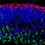 Induced pluripotent stem cells form a structure with layers of cells.