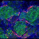 Human stem cell-derived beta cells.