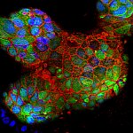 Placental cells grown in bioreactor