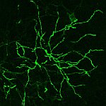 Confocal microscope image of neurons