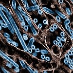 Electron micrograph shows long rods and circular cross-sections of virus particles.